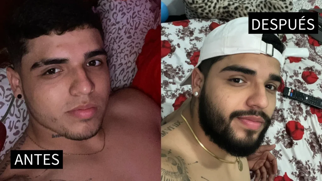 antes y despues